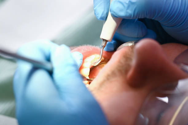 Best Emergency Treatment for Toothache in East Newark, NJ